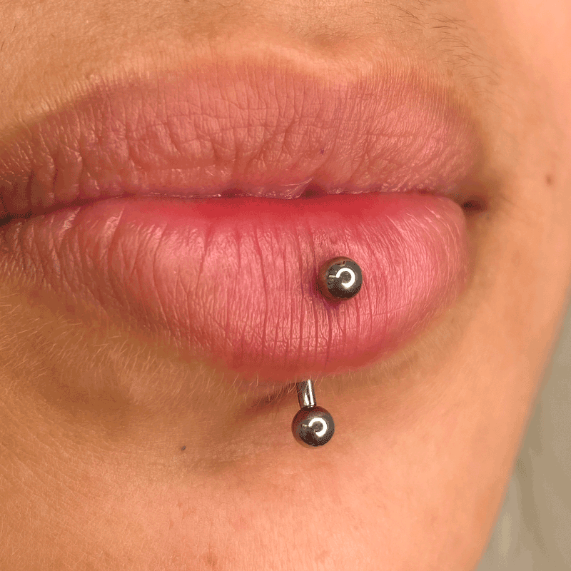 Labio